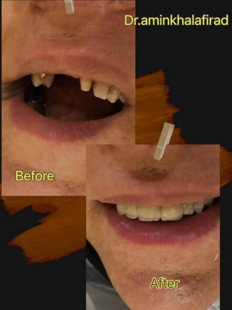 مطب دندانپزشکی دکتر امین خلفی راد در دزفول